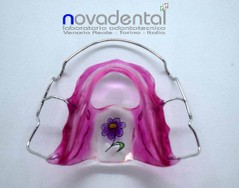 Elevatore linguale notturo di Bonnet.jpg